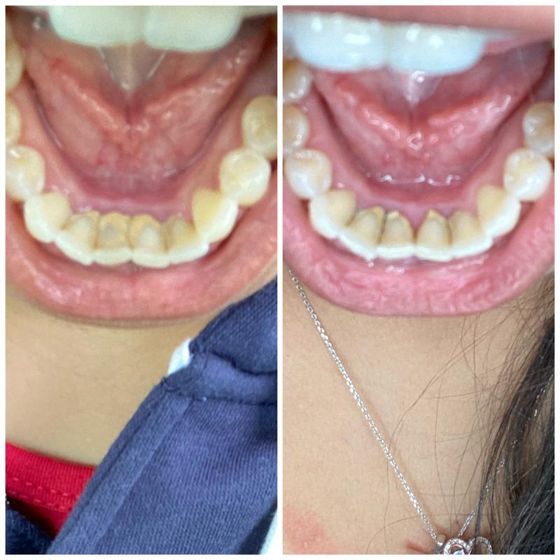 GuruNandha™️ Coconut Oil Pulling w/ Essential Oils